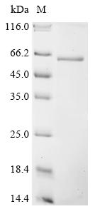 (Tris-Glycine gel) Discontinuous SDS-PAGE (reduced) with 5% enrichment gel and 15% separation gel. (Tris-Glycine gel) Discontinuous SDS-PAGE (reduced) with 5% enrichment gel and 15% separation gel.