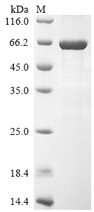 (Tris-Glycine gel) Discontinuous SDS-PAGE (reduced) with 5% enrichment gel and 15% separation gel. (Tris-Glycine gel) Discontinuous SDS-PAGE (reduced) with 5% enrichment gel and 15% separation gel.