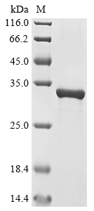 (Tris-Glycine gel) Discontinuous SDS-PAGE (reduced) with 5% enrichment gel and 15% separation gel. (Tris-Glycine gel) Discontinuous SDS-PAGE (reduced) with 5% enrichment gel and 15% separation gel.