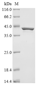 (Tris-Glycine gel) Discontinuous SDS-PAGE (reduced) with 5% enrichment gel and 15% separation gel.