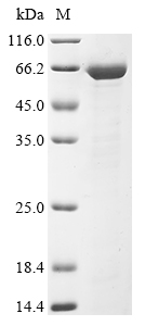 (Tris-Glycine gel) Discontinuous SDS-PAGE (reduced) with 5% enrichment gel and 15% separation gel. (Tris-Glycine gel) Discontinuous SDS-PAGE (reduced) with 5% enrichment gel and 15% separation gel.