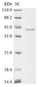 (Tris-Glycine gel) Discontinuous SDS-PAGE (reduced) with 5% enrichment gel and 15% separation gel.