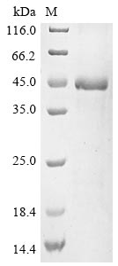 (Tris-Glycine gel) Discontinuous SDS-PAGE (reduced) with 5% enrichment gel and 15% separation gel. (Tris-Glycine gel) Discontinuous SDS-PAGE (reduced) with 5% enrichment gel and 15% separation gel.