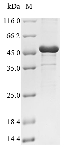 (Tris-Glycine gel) Discontinuous SDS-PAGE (reduced) with 5% enrichment gel and 15% separation gel. (Tris-Glycine gel) Discontinuous SDS-PAGE (reduced) with 5% enrichment gel and 15% separation gel.