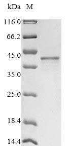 (Tris-Glycine gel) Discontinuous SDS-PAGE (reduced) with 5% enrichment gel and 15% separation gel. (Tris-Glycine gel) Discontinuous SDS-PAGE (reduced) with 5% enrichment gel and 15% separation gel.