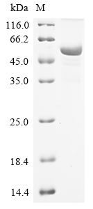 (Tris-Glycine gel) Discontinuous SDS-PAGE (reduced) with 5% enrichment gel and 15% separation gel. (Tris-Glycine gel) Discontinuous SDS-PAGE (reduced) with 5% enrichment gel and 15% separation gel.