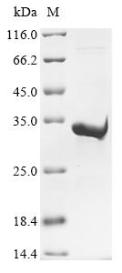 (Tris-Glycine gel) Discontinuous SDS-PAGE (reduced) with 5% enrichment gel and 15% separation gel. (Tris-Glycine gel) Discontinuous SDS-PAGE (reduced) with 5% enrichment gel and 15% separation gel.