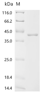 (Tris-Glycine gel) Discontinuous SDS-PAGE (reduced) with 5% enrichment gel and 15% separation gel.