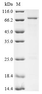 (Tris-Glycine gel) Discontinuous SDS-PAGE (reduced) with 5% enrichment gel and 15% separation gel. (Tris-Glycine gel) Discontinuous SDS-PAGE (reduced) with 5% enrichment gel and 15% separation gel.