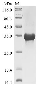 (Tris-Glycine gel) Discontinuous SDS-PAGE (reduced) with 5% enrichment gel and 15% separation gel. (Tris-Glycine gel) Discontinuous SDS-PAGE (reduced) with 5% enrichment gel and 15% separation gel.