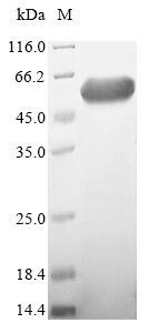 (Tris-Glycine gel) Discontinuous SDS-PAGE (reduced) with 5% enrichment gel and 15% separation gel. (Tris-Glycine gel) Discontinuous SDS-PAGE (reduced) with 5% enrichment gel and 15% separation gel.