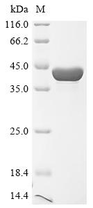 (Tris-Glycine gel) Discontinuous SDS-PAGE (reduced) with 5% enrichment gel and 15% separation gel.