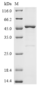 (Tris-Glycine gel) Discontinuous SDS-PAGE (reduced) with 5% enrichment gel and 15% separation gel.