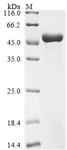 (Tris-Glycine gel) Discontinuous SDS-PAGE (reduced) with 5% enrichment gel and 15% separation gel. (Tris-Glycine gel) Discontinuous SDS-PAGE (reduced) with 5% enrichment gel and 15% separation gel.