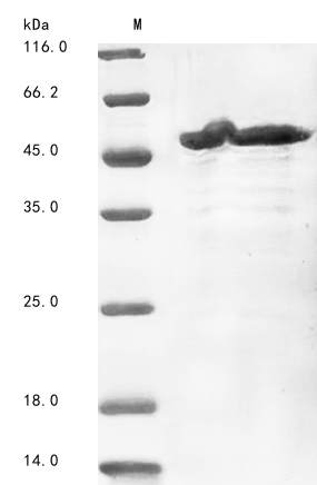 (Tris-Glycine gel) Discontinuous SDS-PAGE (reduced) with 5% enrichment gel and 15% separation gel. (Tris-Glycine gel) Discontinuous SDS-PAGE (reduced) with 5% enrichment gel and 15% separation gel.