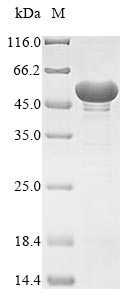(Tris-Glycine gel) Discontinuous SDS-PAGE (reduced) with 5% enrichment gel and 15% separation gel.