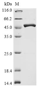 (Tris-Glycine gel) Discontinuous SDS-PAGE (reduced) with 5% enrichment gel and 15% separation gel. (Tris-Glycine gel) Discontinuous SDS-PAGE (reduced) with 5% enrichment gel and 15% separation gel.