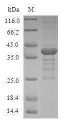 (Tris-Glycine gel) Discontinuous SDS-PAGE (reduced) with 5% enrichment gel and 15% separation gel. (Tris-Glycine gel) Discontinuous SDS-PAGE (reduced) with 5% enrichment gel and 15% separation gel.