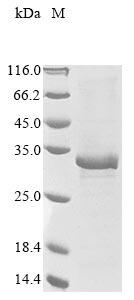 (Tris-Glycine gel) Discontinuous SDS-PAGE (reduced) with 5% enrichment gel and 15% separation gel. (Tris-Glycine gel) Discontinuous SDS-PAGE (reduced) with 5% enrichment gel and 15% separation gel.