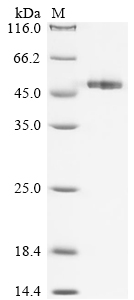 (Tris-Glycine gel) Discontinuous SDS-PAGE (reduced) with 5% enrichment gel and 15% separation gel.