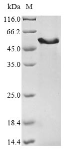 (Tris-Glycine gel) Discontinuous SDS-PAGE (reduced) with 5% enrichment gel and 15% separation gel. (Tris-Glycine gel) Discontinuous SDS-PAGE (reduced) with 5% enrichment gel and 15% separation gel.