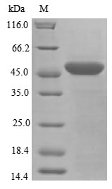 SDS-PAGE- Recombinant protein Human PARK7