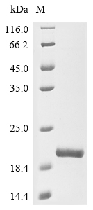 (Tris-Glycine gel) Discontinuous SDS-PAGE (reduced) with 5% enrichment gel and 15% separation gel. (Tris-Glycine gel) Discontinuous SDS-PAGE (reduced) with 5% enrichment gel and 15% separation gel.