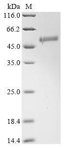 (Tris-Glycine gel) Discontinuous SDS-PAGE (reduced) with 5% enrichment gel and 15% separation gel. (Tris-Glycine gel) Discontinuous SDS-PAGE (reduced) with 5% enrichment gel and 15% separation gel.