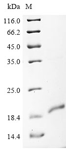 (Tris-Glycine gel) Discontinuous SDS-PAGE (reduced) with 5% enrichment gel and 15% separation gel. (Tris-Glycine gel) Discontinuous SDS-PAGE (reduced) with 5% enrichment gel and 15% separation gel.