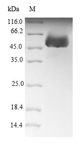 (Tris-Glycine gel) Discontinuous SDS-PAGE (reduced) with 5% enrichment gel and 15% separation gel. (Tris-Glycine gel) Discontinuous SDS-PAGE (reduced) with 5% enrichment gel and 15% separation gel.