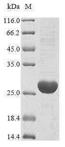 (Tris-Glycine gel) Discontinuous SDS-PAGE (reduced) with 5% enrichment gel and 15% separation gel. (Tris-Glycine gel) Discontinuous SDS-PAGE (reduced) with 5% enrichment gel and 15% separation gel.