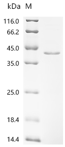 (Tris-Glycine gel) Discontinuous SDS-PAGE (reduced) with 5% enrichment gel and 15% separation gel.