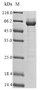 (Tris-Glycine gel) Discontinuous SDS-PAGE (reduced) with 5% enrichment gel and 15% separation gel. (Tris-Glycine gel) Discontinuous SDS-PAGE (reduced) with 5% enrichment gel and 15% separation gel.