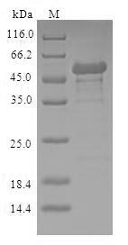 (Tris-Glycine gel) Discontinuous SDS-PAGE (reduced) with 5% enrichment gel and 15% separation gel. (Tris-Glycine gel) Discontinuous SDS-PAGE (reduced) with 5% enrichment gel and 15% separation gel.