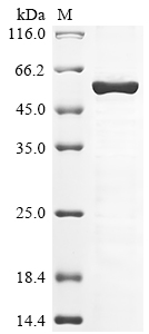 (Tris-Glycine gel) Discontinuous SDS-PAGE (reduced) with 5% enrichment gel and 15% separation gel. (Tris-Glycine gel) Discontinuous SDS-PAGE (reduced) with 5% enrichment gel and 15% separation gel.