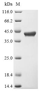 (Tris-Glycine gel) Discontinuous SDS-PAGE (reduced) with 5% enrichment gel and 15% separation gel. (Tris-Glycine gel) Discontinuous SDS-PAGE (reduced) with 5% enrichment gel and 15% separation gel.