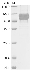 (Tris-Glycine gel) Discontinuous SDS-PAGE (reduced) with 5% enrichment gel and 15% separation gel. (Tris-Glycine gel) Discontinuous SDS-PAGE (reduced) with 5% enrichment gel and 15% separation gel.