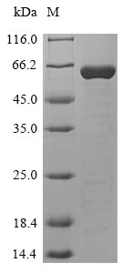 (Tris-Glycine gel) Discontinuous SDS-PAGE (reduced) with 5% enrichment gel and 15% separation gel. (Tris-Glycine gel) Discontinuous SDS-PAGE (reduced) with 5% enrichment gel and 15% separation gel.