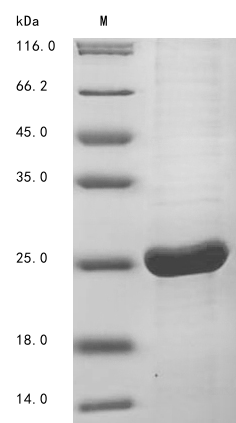 (Tris-Glycine gel) Discontinuous SDS-PAGE (reduced) with 5% enrichment gel and 15% separation gel. (Tris-Glycine gel) Discontinuous SDS-PAGE (reduced) with 5% enrichment gel and 15% separation gel.