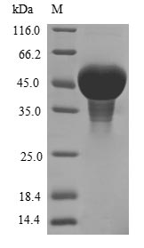 (Tris-Glycine gel) Discontinuous SDS-PAGE (reduced) with 5% enrichment gel and 15% separation gel.