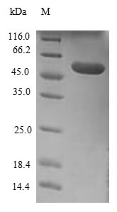 (Tris-Glycine gel) Discontinuous SDS-PAGE (reduced) with 5% enrichment gel and 15% separation gel. (Tris-Glycine gel) Discontinuous SDS-PAGE (reduced) with 5% enrichment gel and 15% separation gel.