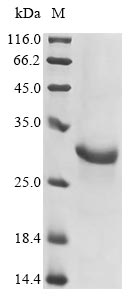 (Tris-Glycine gel) Discontinuous SDS-PAGE (reduced) with 5% enrichment gel and 15% separation gel.