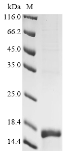 (Tris-Glycine gel) Discontinuous SDS-PAGE (reduced) with 5% enrichment gel and 15% separation gel. (Tris-Glycine gel) Discontinuous SDS-PAGE (reduced) with 5% enrichment gel and 15% separation gel.