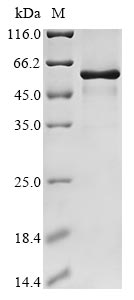 (Tris-Glycine gel) Discontinuous SDS-PAGE (reduced) with 5% enrichment gel and 15% separation gel. (Tris-Glycine gel) Discontinuous SDS-PAGE (reduced) with 5% enrichment gel and 15% separation gel.