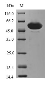 (Tris-Glycine gel) Discontinuous SDS-PAGE (reduced) with 5% enrichment gel and 15% separation gel. (Tris-Glycine gel) Discontinuous SDS-PAGE (reduced) with 5% enrichment gel and 15% separation gel.