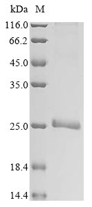 (Tris-Glycine gel) Discontinuous SDS-PAGE (reduced) with 5% enrichment gel and 15% separation gel. (Tris-Glycine gel) Discontinuous SDS-PAGE (reduced) with 5% enrichment gel and 15% separation gel.