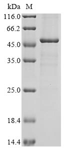(Tris-Glycine gel) Discontinuous SDS-PAGE (reduced) with 5% enrichment gel and 15% separation gel. (Tris-Glycine gel) Discontinuous SDS-PAGE (reduced) with 5% enrichment gel and 15% separation gel.