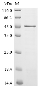 (Tris-Glycine gel) Discontinuous SDS-PAGE (reduced) with 5% enrichment gel and 15% separation gel.