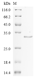 (Tris-Glycine gel) Discontinuous SDS-PAGE (reduced) with 5% enrichment gel and 15% separation gel. (Tris-Glycine gel) Discontinuous SDS-PAGE (reduced) with 5% enrichment gel and 15% separation gel.