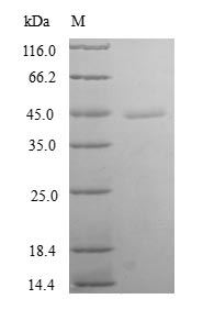 (Tris-Glycine gel) Discontinuous SDS-PAGE (reduced) with 5% enrichment gel and 15% separation gel.